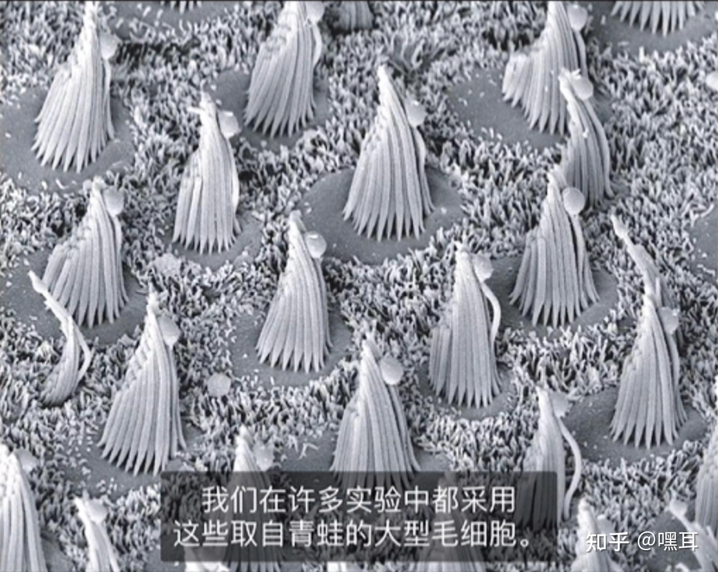 我国科学家破解耳蜗听觉毛细胞发育“基因密码”